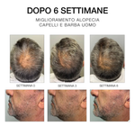DIEGO DALLA PALMA ESTREMIRIMEDI 6 SCALP AND HAIR FORTIFYING TREATMENT 50ML