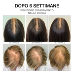 DIEGO DALLA PALMA ESTREMIRIMEDI 6 SCALP AND HAIR FORTIFYING TREATMENT   50ML