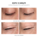 Rvb Lab Meso Fill Concealer Fill&Correct Smoothing Treatment Corrector